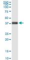 Forkhead Box A2 antibody, H00003170-M07, Novus Biologicals, Western Blot image 