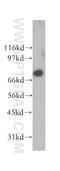 Armadillo Repeat Containing 8 antibody, 12653-1-AP, Proteintech Group, Western Blot image 