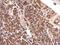 Malate Dehydrogenase 2 antibody, PA5-21700, Invitrogen Antibodies, Immunohistochemistry paraffin image 