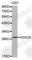 Homeobox C8 antibody, A2975, ABclonal Technology, Western Blot image 