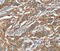 G Protein Subunit Alpha 13 antibody, MBS2524249, MyBioSource, Immunohistochemistry paraffin image 