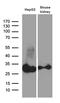 Dehydrogenase/Reductase 4 Like 2 antibody, M16262, Boster Biological Technology, Western Blot image 