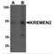 Kringle Containing Transmembrane Protein 2 antibody, MBS153545, MyBioSource, Western Blot image 