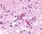 Neuromedin B Receptor antibody, NLS825, Novus Biologicals, Immunohistochemistry paraffin image 