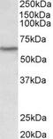 LCK Proto-Oncogene, Src Family Tyrosine Kinase antibody, MBS422843, MyBioSource, Western Blot image 