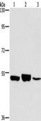 Interferon Regulatory Factor 6 antibody, TA349362, Origene, Western Blot image 
