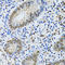 Metastasis-associated protein MTA3 antibody, LS-C334858, Lifespan Biosciences, Immunohistochemistry frozen image 
