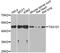 Tumor Susceptibility 101 antibody, abx126743, Abbexa, Western Blot image 