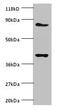 NADH:Ubiquinone Oxidoreductase Subunit S5 antibody, MBS715106, MyBioSource, Western Blot image 
