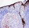 Cystatin A antibody, PA2105, Boster Biological Technology, Immunohistochemistry paraffin image 