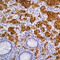 Chromogranin A antibody, LS-C88144, Lifespan Biosciences, Immunohistochemistry paraffin image 