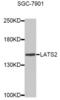 Large Tumor Suppressor Kinase 2 antibody, abx005403, Abbexa, Western Blot image 