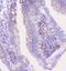 Properdin antibody, A00852-2, Boster Biological Technology, Immunohistochemistry paraffin image 