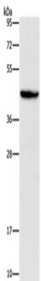 Orosomucoid 2 antibody, TA349674, Origene, Western Blot image 