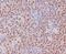 Paired box protein Pax-5 antibody, M00669, Boster Biological Technology, Immunohistochemistry paraffin image 