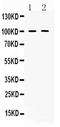 Phosphodiesterase 5A antibody, A02490-2, Boster Biological Technology, Western Blot image 