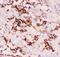 Integrin Subunit Beta 2 antibody, PA5-79538, Invitrogen Antibodies, Immunohistochemistry frozen image 