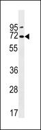 Polycystin 2 Like 2, Transient Receptor Potential Cation Channel antibody, 60-048, ProSci, Western Blot image 