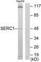Serine Incorporator 1 antibody, TA315668, Origene, Western Blot image 