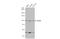 B-Raf Proto-Oncogene, Serine/Threonine Kinase antibody, GTX100913, GeneTex, Western Blot image 