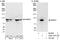 N(Alpha)-Acetyltransferase 15, NatA Auxiliary Subunit antibody, A302-147A, Bethyl Labs, Western Blot image 