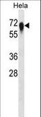 CD55 Molecule (Cromer Blood Group) antibody, LS-C168550, Lifespan Biosciences, Western Blot image 