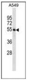 STAM Binding Protein antibody, AP54063PU-N, Origene, Western Blot image 