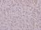 Protein Kinase C Zeta antibody, GTX66730, GeneTex, Immunohistochemistry paraffin image 