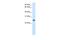 Gamma-Glutamyltransferase Light Chain 1 antibody, A16449, Boster Biological Technology, Western Blot image 