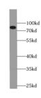 Procollagen-Lysine,2-Oxoglutarate 5-Dioxygenase 3 antibody, FNab06554, FineTest, Western Blot image 