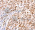 Homeobox C8 antibody, A2975, ABclonal Technology, Immunohistochemistry paraffin image 