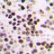 G Protein-Coupled Receptor 12 antibody, orb213992, Biorbyt, Immunohistochemistry paraffin image 