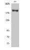 Insulin Receptor Substrate 1 antibody, A00268S639, Boster Biological Technology, Western Blot image 