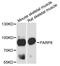 Poly(ADP-Ribose) Polymerase Family Member 8 antibody, A15145, Boster Biological Technology, Western Blot image 