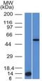 ALK p80 antibody, GTX34401, GeneTex, Western Blot image 