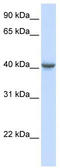 Gamma-Aminobutyric Acid Type A Receptor Alpha1 Subunit antibody, TA338500, Origene, Western Blot image 