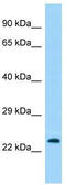 Transmembrane Protein 114 antibody, TA332175, Origene, Western Blot image 