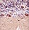 Potassium Voltage-Gated Channel Subfamily A Member 1 antibody, LS-C165408, Lifespan Biosciences, Immunohistochemistry paraffin image 
