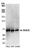 Diacylglycerol Lipase Beta antibody, A304-480A, Bethyl Labs, Western Blot image 