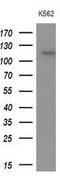 Apolipoprotein B Receptor antibody, M09242, Boster Biological Technology, Western Blot image 