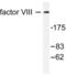 Coagulation Factor VIII antibody, LS-C176016, Lifespan Biosciences, Western Blot image 