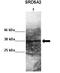 DNA Fragmentation Factor Subunit Alpha antibody, orb77376, Biorbyt, Western Blot image 