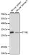 Chymotrypsinogen B1 antibody, A15043, ABclonal Technology, Western Blot image 
