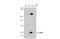 Ribonucleotide Reductase Catalytic Subunit M1 antibody, GTX100758, GeneTex, Western Blot image 