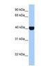 Casein Kinase 2 Alpha 1 antibody, NBP1-56690, Novus Biologicals, Western Blot image 