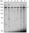 Chromodomain Helicase DNA Binding Protein 3 antibody, MA5-15579, Invitrogen Antibodies, Western Blot image 