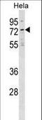 Neuroepithelial Cell Transforming 1 antibody, LS-C158378, Lifespan Biosciences, Western Blot image 