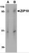 Solute Carrier Family 39 Member 10 antibody, 4991, ProSci, Western Blot image 