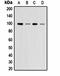 Mitogen-activated protein kinase 6 antibody, orb323264, Biorbyt, Western Blot image 