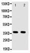 Annexin A10 antibody, PA5-78779, Invitrogen Antibodies, Western Blot image 